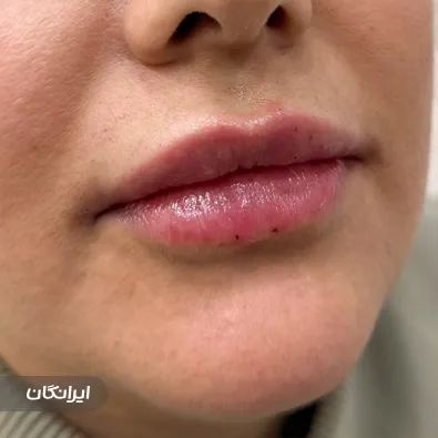 کلینیک زیبایی دکتر مریم خسرویان