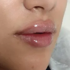 کلینیک زیبایی دکتر مریم خسرویان