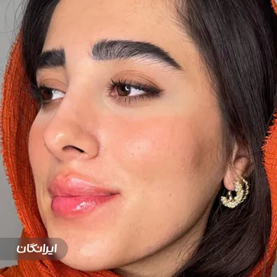 کلینیک زیبایی دکتر شیما کرد