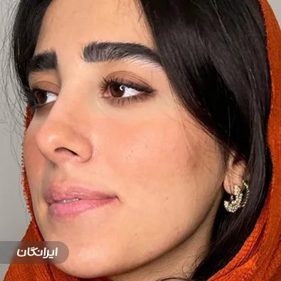 کلینیک زیبایی دکتر شیما کرد