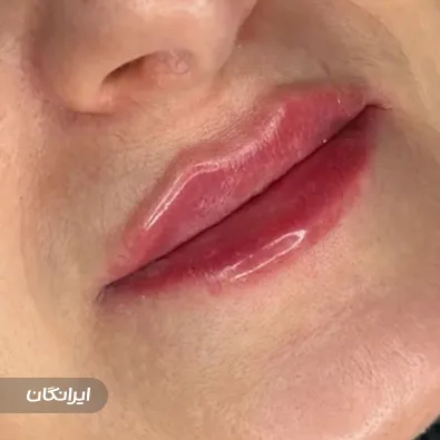 کلینیک زیبایی دکتر مسعود هاشمی