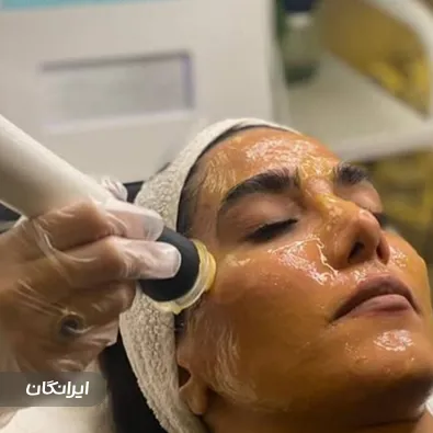 فیشیالیست فاطمه عباسی