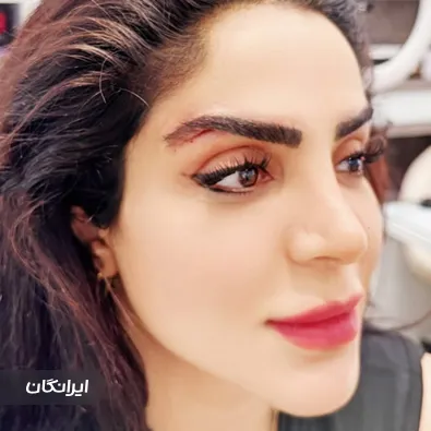 کلینیک زیبایی پریکا