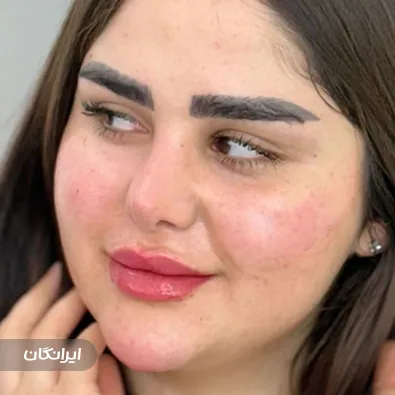 کلینیک زیبایی الا