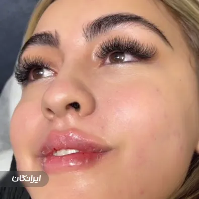 کلینیک زیبایی آرمیتا