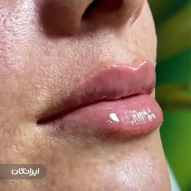 کلینیک زیبایی آرمیتا