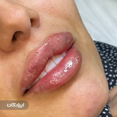 کلینیک زیبایی آرمیتا