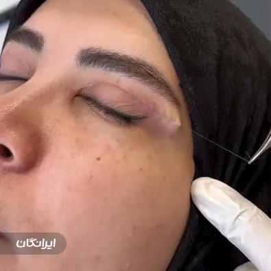 کلینیک جراحی رتینا