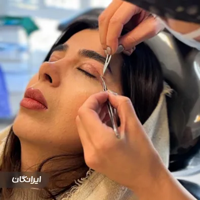 کلینیک جراحی رتینا