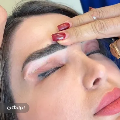 کلینیک جراحی رتینا