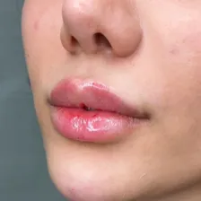 کلینیک زیبایی دکتر نازنین امامی پور