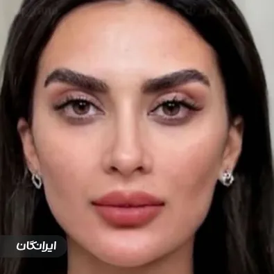 کلینیک زیبایی فیل بیوتی