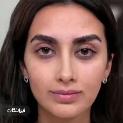 کلینیک زیبایی فیل بیوتی