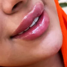 کلینیک زیبایی فیل بیوتی