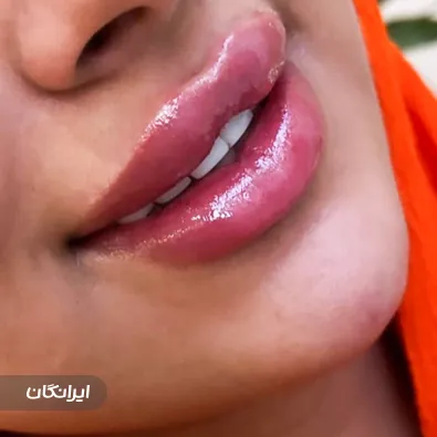 کلینیک زیبایی فیل بیوتی