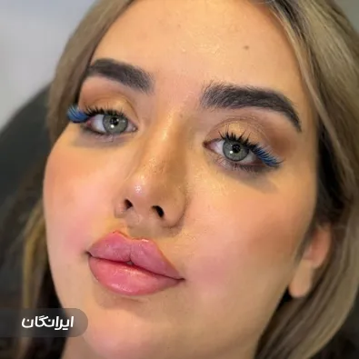 کلینیک زیبایی مهسا