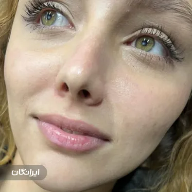 کلینیک زیبایی مهسا