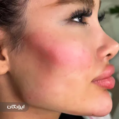 کلینیک زیبایی مهرسا