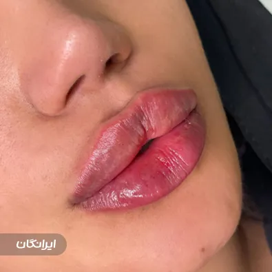 کلینیک زیبایی دکتر مریم علی غنی