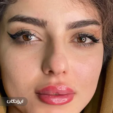 کلینیک زیبایی دکتر مریم علی غنی