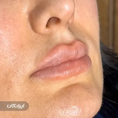 کلینیک زیبایی فرنیسا