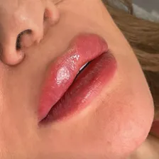 کلینیک زیبایی فرنیسا