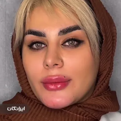 کلینیک زیبایی ادرن