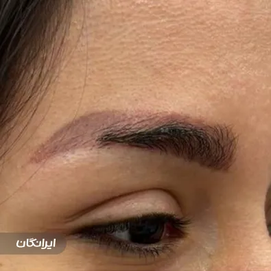 کلینیک زیبایی ماهرو