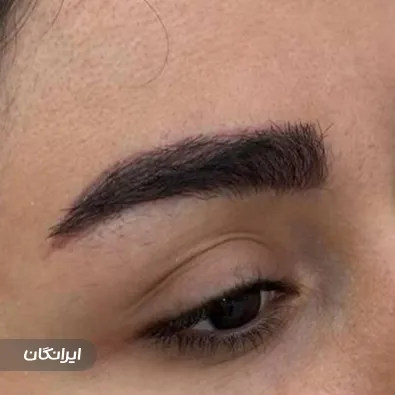 کلینیک زیبایی ماهرو