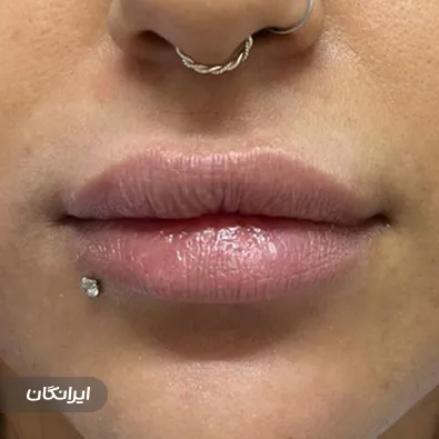 کلینیک زیبایی دکتر نگین جعفری