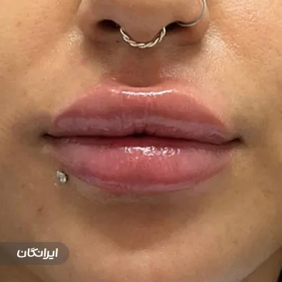 کلینیک زیبایی دکتر نگین جعفری