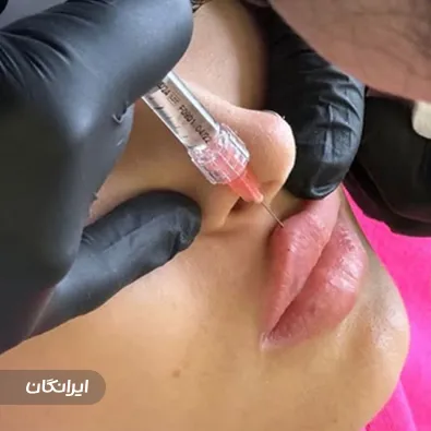 کلینیک زیبایی برژان