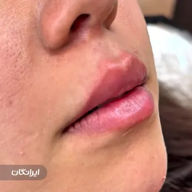 کلینیک زیبایی برژان