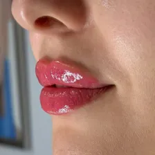 کلینیک زیبایی دکتر بهاره اسکندری