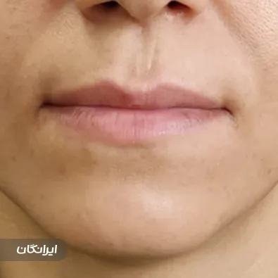 کلینیک زیبایی دکتر شعله علیزاده