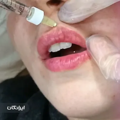 کلینیک زیبایی دکتر شعله علیزاده