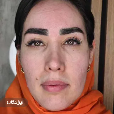 کلینیک زیبایی دکتر مهلا بلوچ