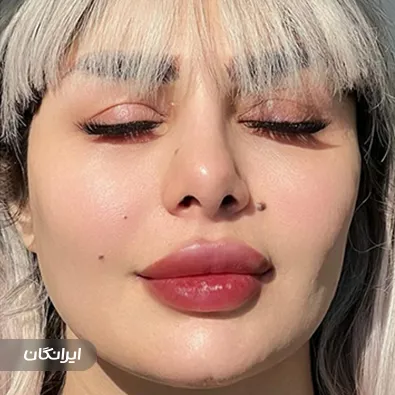 کلینیک زیبایی حریری