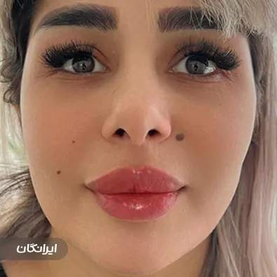 کلینیک زیبایی حریری