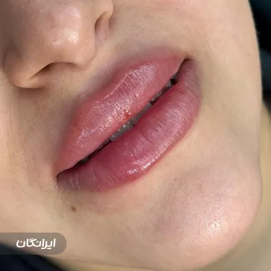 کلینیک زیبایی دکتر آزاده سلیمانی