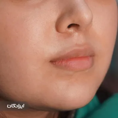 کلینیک زیبایی دیاموند