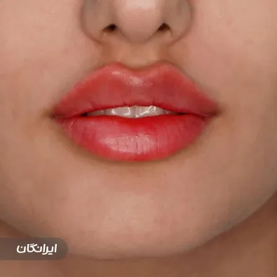 کلینیک زیبایی دیاموند