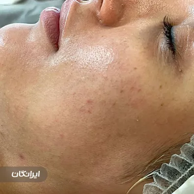 فیشیالیست زیبا روح پرور