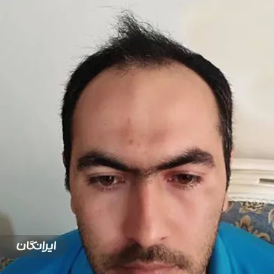 کلینیک کاشت مو جعفرزاده