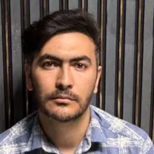 کلینیک کاشت مو جعفرزاده