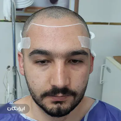 کلینیک کاشت مو جعفرزاده