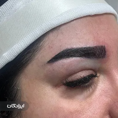 کلینیک کاشت مو سلیمی