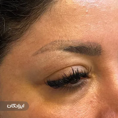 کلینیک کاشت مو سلیمی