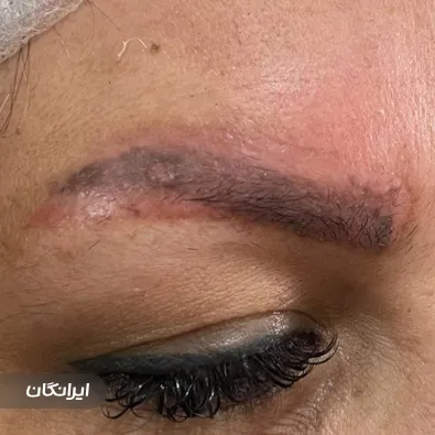 کلینیک کاشت مو سلیمی