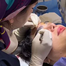 کلینیک کاشت مو نوروزی